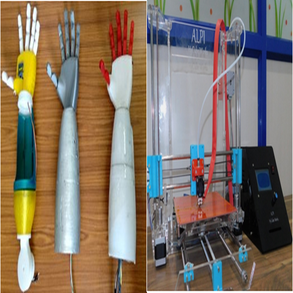 Prosthetic-arm